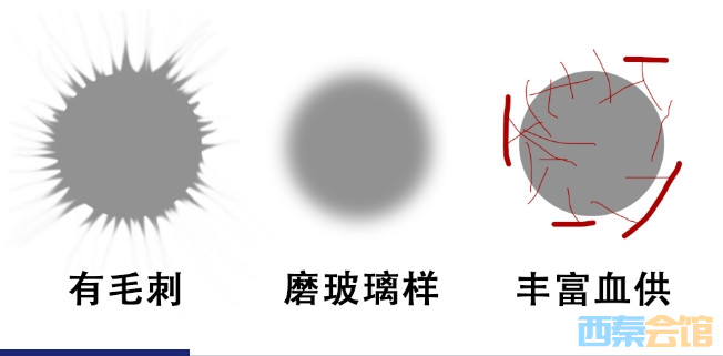 14.png