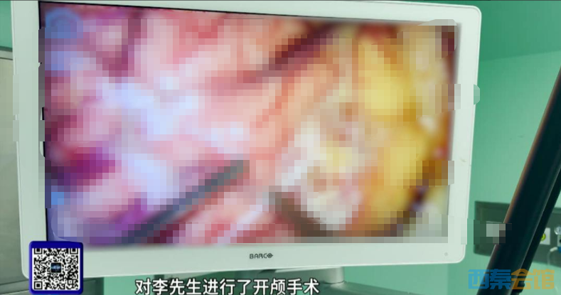 35.png